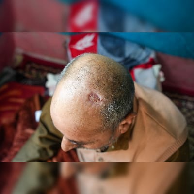 Bear Attacks in Mawer